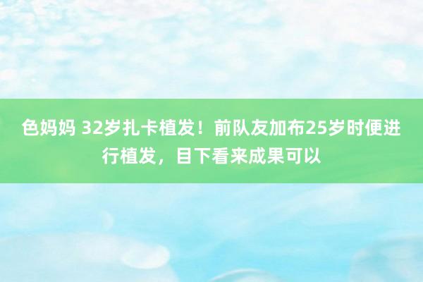 色妈妈 32岁扎卡植发！前队友加布25岁时便进行植发，目下看来成果可以